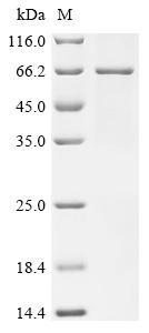 Recombinant Human Leucine-rich repeat LGI family member 2 (LGI2)
