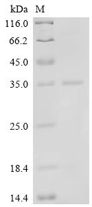 Recombinant Human Vascular endothelial growth factor A (VEGFA)