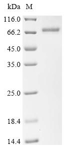Recombinant Human OTU domain-containing protein 5 (OTUD5)