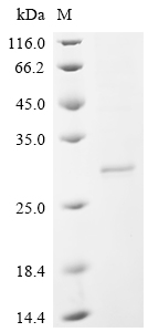 Recombinant Human IL-12 receptor beta component (IL12RB1), partial