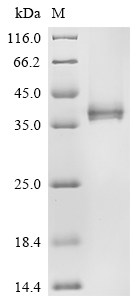 Recombinant Human Interleukin-12 receptor subunit beta-2 (IL12RB2), partial