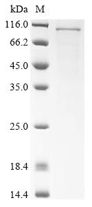 Recombinant Human Heat shock protein HSP 90-beta (HSP90AB1)