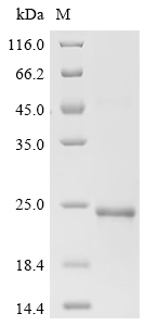 Recombinant Mouse Platelet-derived growth factor subunit B (Pdgfb)