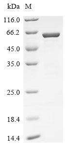 Recombinant Bat coronavirus HKU5 Nucleoprotein (N)