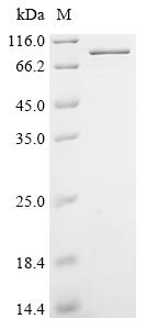 Recombinant Human Serine/threonine-protein kinase RIO1 (RIOK1)