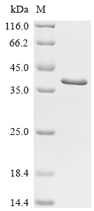 Recombinant Human Vigilin (HDLBP), partial