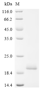 Recombinant Human Sushi, von Willebrand factor type A, EGF and pentraxin domain-containing protein 1 (SVEP1), partial