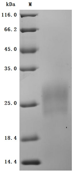 Recombinant Human Gastric inhibitory polypeptide receptor (GIPR), partial (Active)
