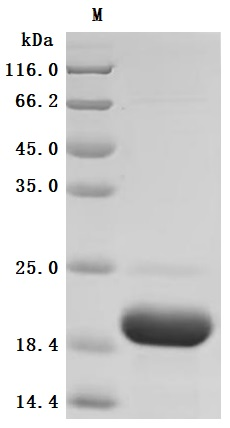 Recombinant Human Kidney-associated antigen 1 (KAAG1) (Active)