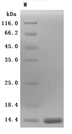 Recombinant Human Kidney-associated antigen 1(KAAG1) (Active)