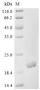 Recombinant Mouse Granulocyte-macrophage colony-stimulating factor (Csf2)