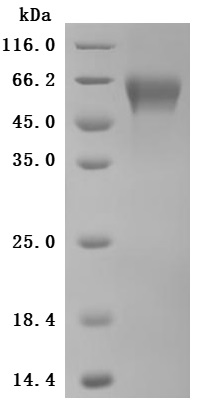 Recombinant Human Cytotoxic and regulatory T-cell molecule (CRTAM), partial (Active)