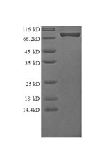 Recombinant Human Granulocyte colony-stimulating factor receptor (CSF3R), partial