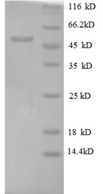 Recombinant Human Oncostatin-M (OSM)