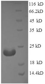 Recombinant Mouse Adiponectin (Adipoq), partial