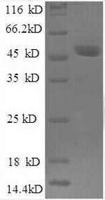 Recombinant Human Ubiquitin thioesterase OTUB1 (OTUB1), partial