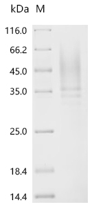 Recombinant Human Interleukin-4 receptor subunit alpha (IL4R), partial