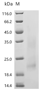 Recombinant Human Interleukin-3 (IL3) (Active)