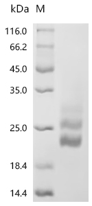 Recombinant Mouse Macrophage colony-stimulating factor 1 (Csf1), partial