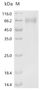 Recombinant Human Sodium-dependent phosphate transport protein 2B (SLC34A2), partial (Active)