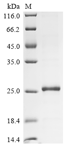 Recombinant Human Interleukin-21 (IL21), partial