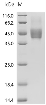 Recombinant Human Fibroblast growth factor receptor 3 (FGFR3), partial (Active)