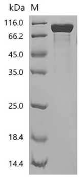 Recombinant Human Granulocyte colony-stimulating factor receptor (CSF3R), partial