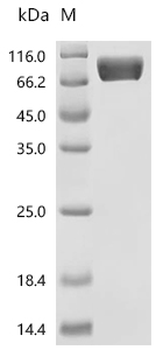 Recombinant Mouse Mast/stem cell growth factor receptor Kit (Kit), partial (Active)