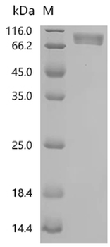 Recombinant Human Platelet-derived growth factor receptor alpha (PDGFRA), partial (Active)
