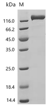 Recombinant Human Receptor-type tyrosine-protein phosphatase C (PTPRC), partial (Active)