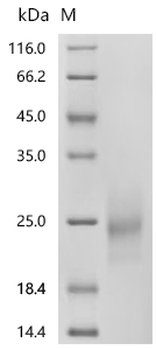 Recombinant Human Macrophage colony-stimulating factor 1 (CSF1), partial (Active)