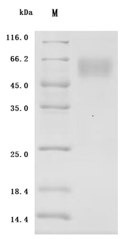 Recombinant Human B-cell antigen receptor complex-associated protein alpha chain (CD79A), partial (Active)