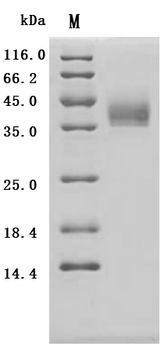 Recombinant Human Paired box protein Pax-8 (PAX8), partial (Active)