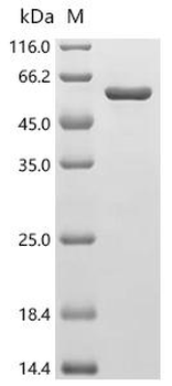 Recombinant Human cAMP-dependent protein kinase type I-alpha regulatory subunit (PRKAR1A)