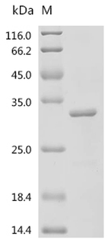 Recombinant Mouse Fibroblast growth factor 21 (Fgf21)
