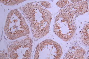 HSPA1A/HSPA1B Antibody