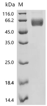 Recombinant Human Fibroblast growth factor receptor 3 (FGFR3), partial