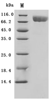 Recombinant Human Platelet-derived growth factor receptor beta (PDGFRB), partial (Active)