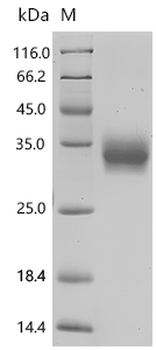 Recombinant Mouse T-cell surface glycoprotein CD8 alpha chain (Cd8a), partial, Biotinylated