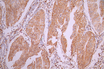 HLA-DQA1 Antibody