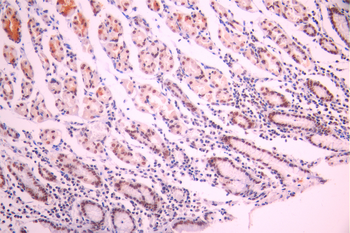 RNF40 Antibody