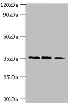 FOSL2 Antibody
