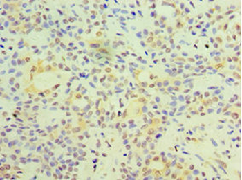 FOSL2 Antibody