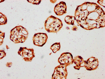 AMOT Antibody