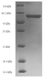 Human TDT protein
