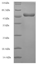 Viral VP40 protein