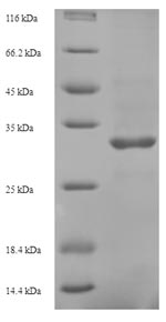 Viral HBV-D protein