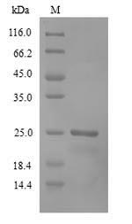 Human RCVRN protein