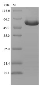Human C6orf144 protein