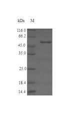 Human SRR protein